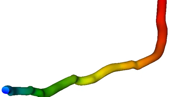 2. intravascular_ultrasound-3-Ansys_Fluent-pressure